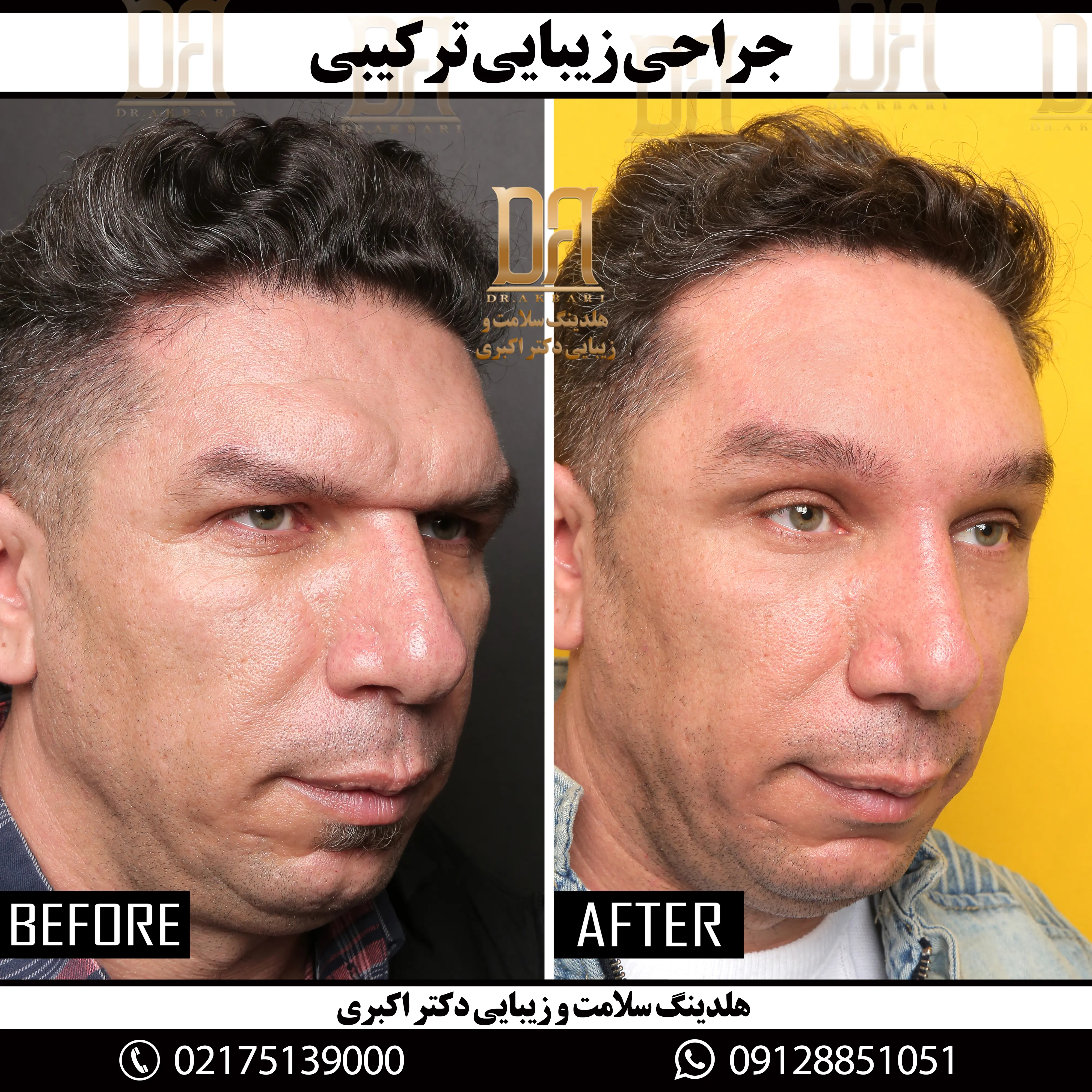 Nft_Profile